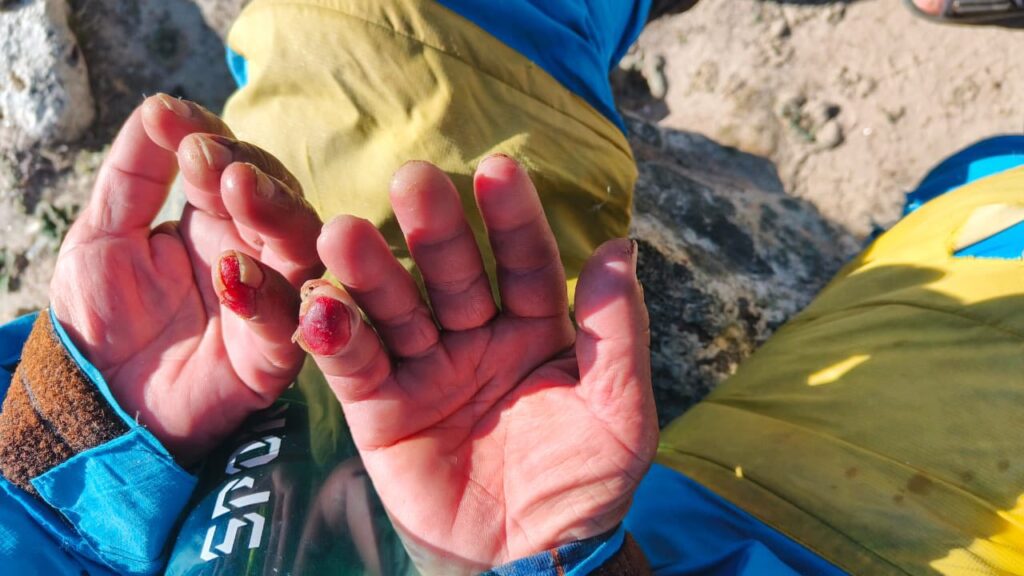 Hillary Dawa Sherpa rescued at Crampon Point Khumbu Glacier Everest base camp SPCC team